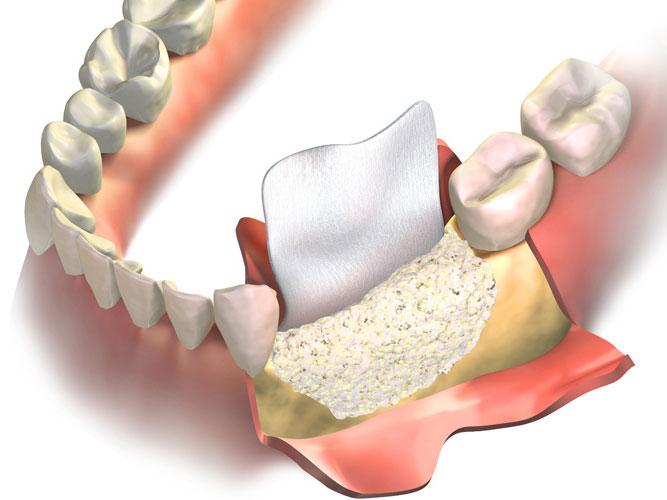 Smile Esthetics Korekcije koštanog i mekog tkiva