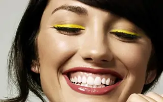 gummy-smile-glavna Stomatoloska ordinacija Beograd